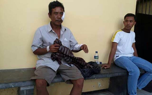 Dokumentasi dari - Insiden Berdarah dari Meja Taruhan di Buleleng